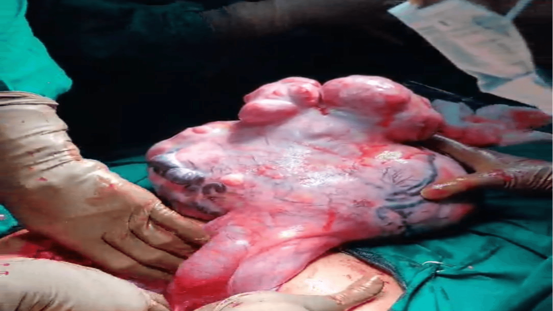 Dr Aparna Ghosh Gynecologist in Chembur