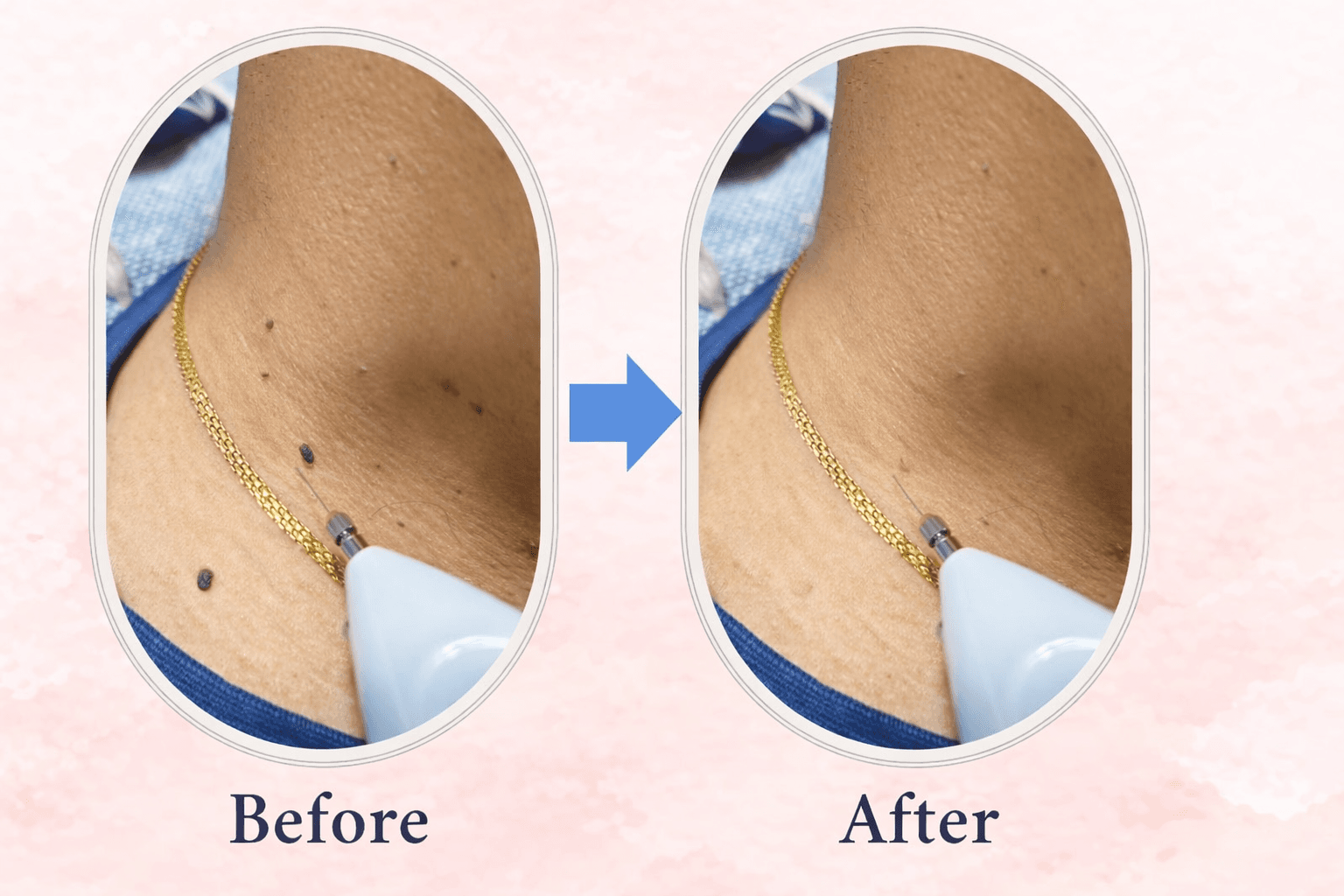 Dr Aparna Ghosh Gynecologist in Chembur